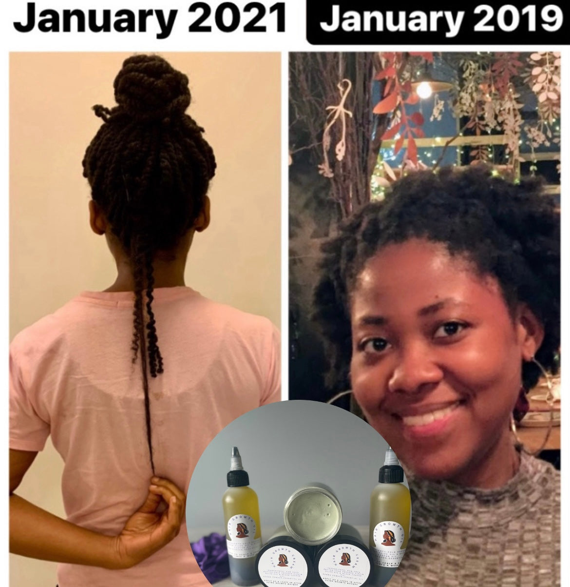 Harvest Hair Growth Bundle